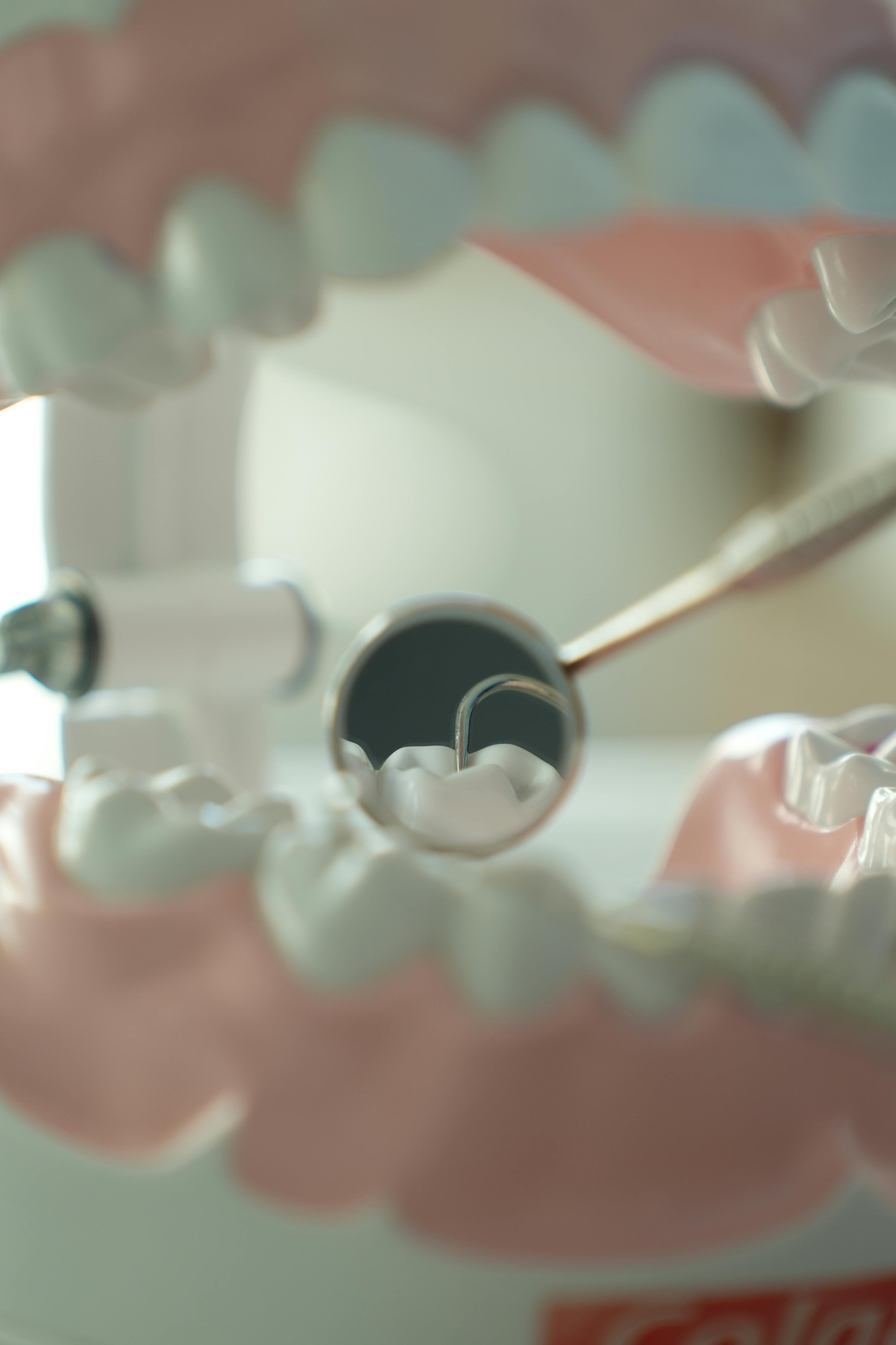 Gentle Extraction